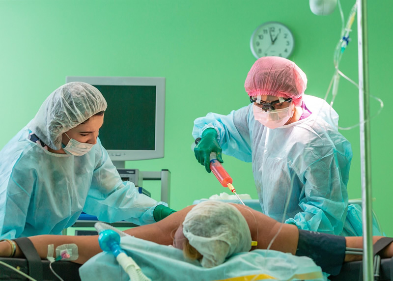 Hidrolipo realizada fora do centro cirúrgico oferece mais risco ao paciente
